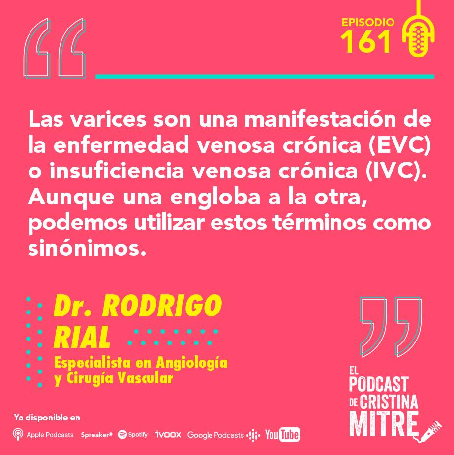 Piernas cansadas varices Podcast de Cristina Mitre Dr. Rial
