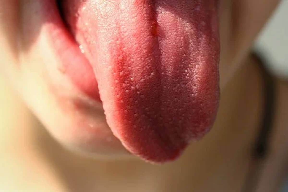 Estiramientos de lengua para tratar la afonía